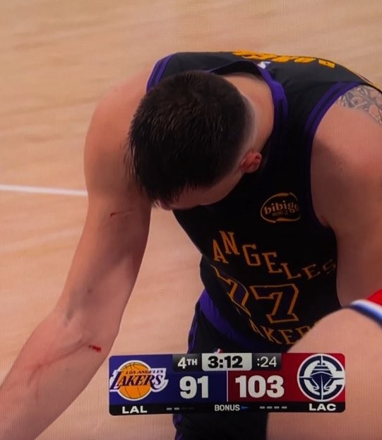 星空.综合体育官网-谁抓的~东契奇罚球时看向手臂 好几道伤口&amp;血迹斑斑